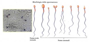 morfologia degli spermatozoi
