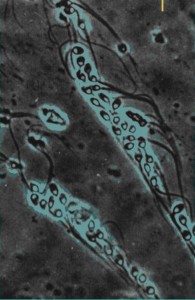 scoppio del follicolo e liberazione dell’ovocita