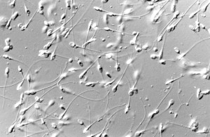 Spermatozoi