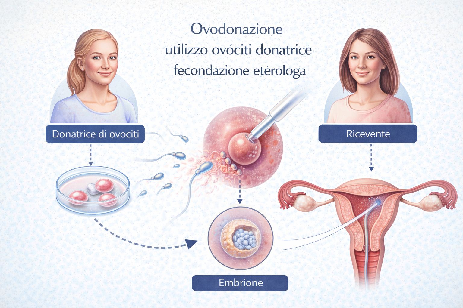 ovodonazione utilizzo ovociti donatrice fecondazione eterologa