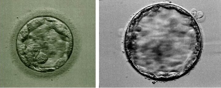 Blastocisti di buona qualità associata a maggiori probabilità di impianto